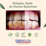 Teeth Whitening Natural Oral Care Tips by Berry Nature Care