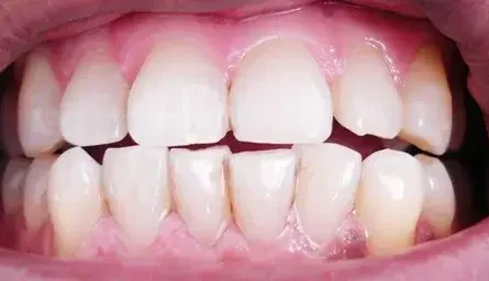 Toothbrite Natural Whitening Tooth Scrub